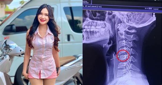 Thai woman, 20, dies weeks after massages that included neck twisting