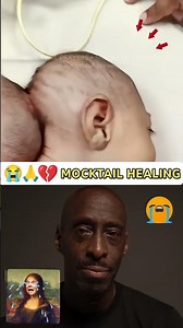 Mocktail Healing Hand ❤️‍🩹🌹