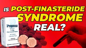 Is Post Finasteride Syndrome Real? | How To Diagnose And Reverse It