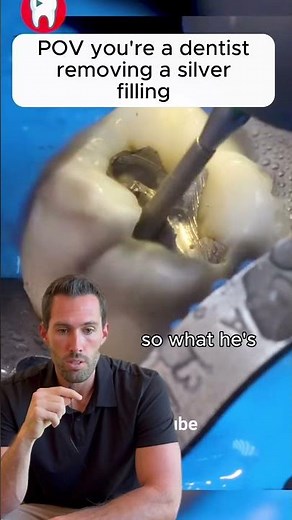 Silver Fillings: The Facts You Should Know