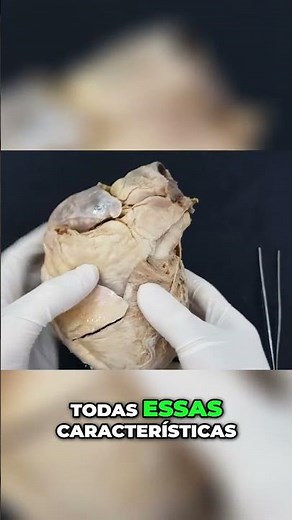 Identificando Estruturas no Coração: Ventrículo Direito e Características Internas Aula de Anatomia