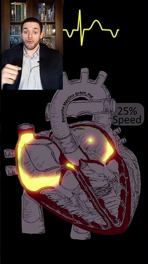 Focal Atrial Tachycardia explained in 1 minute