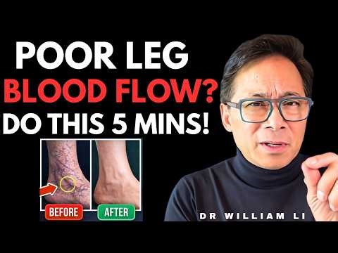 Poor Leg Circulation Explained: 30-Second Test + 3 Smart Fixes | Dr William Li