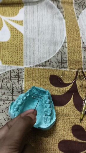 MEDICAL_WORLD on Instagram: "Z spring wire bending # orthodontics # malocclusion #esthetics #dentistry #smile #dental students #mgpgids"