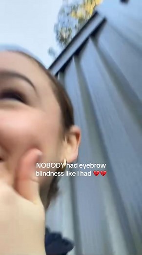 Understanding Eyebrow Blindness: A Personal Journey