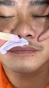 967K views · 5.2K reactions | Satisfying man's mustache waxing hair removal. This is a great to remove the hair and it's better than shaving!✅ #waxingtiktok #asmr #waxing #hardwax #reelsfypシ #reels2023 #reelsvideo #reelsfb #reelsviral #HairWaxing #face #waxing #brazilianwax #reelschallenge #reelsfb #usa #unitedstates #acne #removals | IniyaShow2 | Facebook