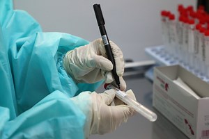 Covid-19 testing capacity under strain, Quest Diagnostics says