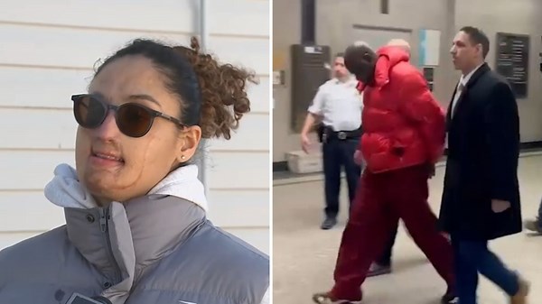 Man charged years after acid attack that severely injured Hofstra student in New York