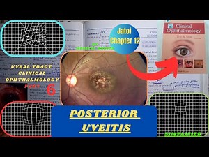 Posterior Uveitis | Chorioretinitis | Jatoi Clinical Ophthalmology | Chapter 12 Part 6