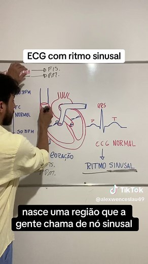 Eletrocardiograma com ritmo sinusal #medicina#medico#doutor#anatomia#fisiologia#doencas#saude#vida#bemestar#videos#coracao#eletrocardiograma#ecg#aulas#faculdade#ensinomedio