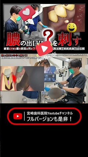 [Inserting XX into the pus discharge site] What is causing the pus on your gums? 15-minute uncut ...