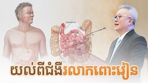 125K views · 12K reactions | យល់ដឹងអំពីជំងឺរលាកពោះវៀន | ចក្ខុវិស័យ...