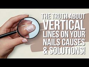 The TRUTH About Vertical Lines on Your Nails Causes & Solutions!