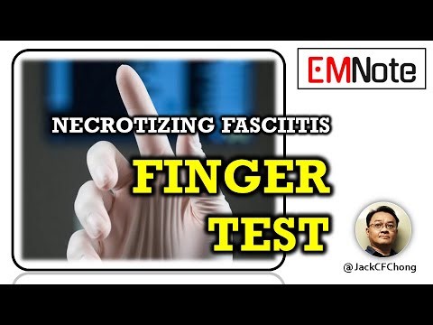 Finger Test for Necrotizing Fasciitis