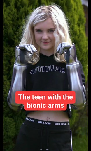 1.5M views · 10K reactions | The teen with the bionic arms #truly #borndifferent #bioniclimbs #bionicarms #reels | Born Different | Facebook