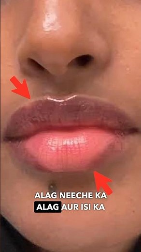 100% Effective Dark Lip Pigmentation Treatment at Home | Lip Brightening at home