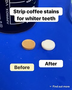 254 reactions · 68 comments | These are so quick and easy to use  https://www.hismileteeth.com | Hismile | Facebook