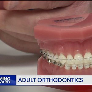 Booming Forward: Getting braces later in life