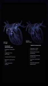 12K views · 117 reactions | DECODING AFIB MECHANISMS: A DUAL THREAT...