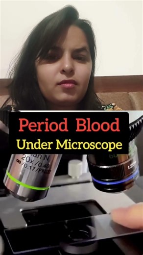 Period blood under microscope #facts #sciencefacts #designerbabies #sciencescandal #healthy #health