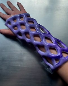 2.5M views · 51K reactions | So much cooler than a normal cast  | Lessons Learned In Life | Facebook