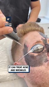 1.2M views · 469 reactions | This looks like the most efficient tattoo removal ever 藍 | Do It Yourself | Facebook