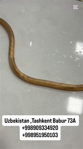 Asrortibservis Klinika on Instagram: "📌 ASKARIDA (Ascaris lumbricoides) nima? 🦠 Askarida — bu ichakda yashovchi dumaloq gijja bo‘lib, asosan bolalarda uchraydi, lekin kattalarda ham bo‘lishi mumkin. Kasallik askaridoz deb ataladi. 🔎 Qanday yuqadi? • Yuvilmagan meva-sabzavotlar orqali • Iflos qo‘l orqali • Toza bo‘lmagan suv orqali ⚠️ Belgilar: – Qorin og‘rig‘i – Ko‘ngil aynishi, qayt qilish – Ishtaha pasayishi – Ozib ketish – Bolalarda bezovtalik va tish g‘ijirlatish – Allergik toshmalar 🫁 L