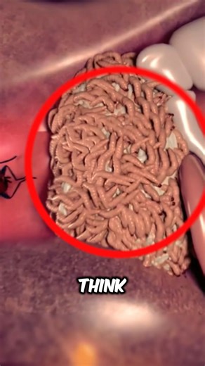 Can Worms Really Crawl Into Your Ear at Night? 😳