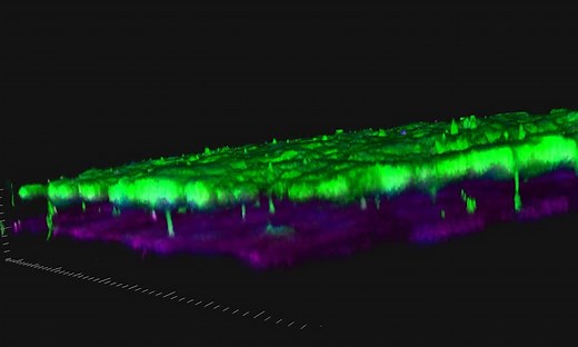 Podocyte Cells: Kidney-on-a-Chip