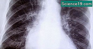 Centriole: Ορισμός, λειτουργία και δομή 💫 Επιστημονική Και Δημοφιλή Ιστοσελίδα Πολυμέσων. 2025