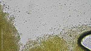 baby feces under the microscope looking at poo with bacteria and bugs in a laboratory