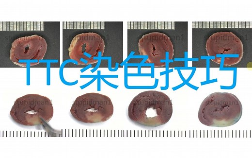 研途指南：TTC染色技巧总结