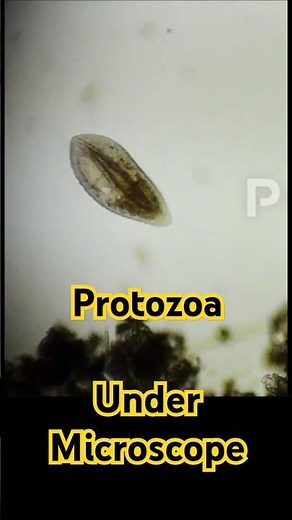Protozoa Under Microscope#protozoa#microscope#phytoplankton#klorofil