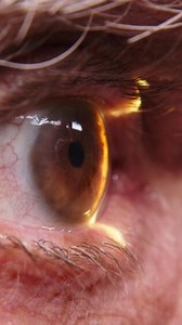 Close-up of a senior man having his vision tested on an ophthalmology diagnostic vision testing equipment. Old man doing eye test with non contact tonometer, checking vision at optical clinic