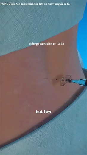 How spinal injection is given?(3D animation) #theflash #doctor #smiledesigndental #periodontics