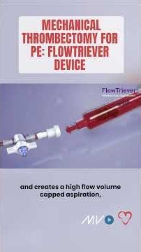 How does FlowTriever clear clots in PE?