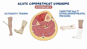Video: Compartment syndrome: Clinical sciences - Video Explanation! | Osmosis | Osmosis