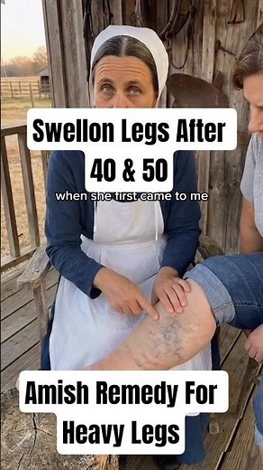 Heavy & Swollen Legs? Amish Natural Home Remedy #amish #health #inflammation #guthealth #wellness