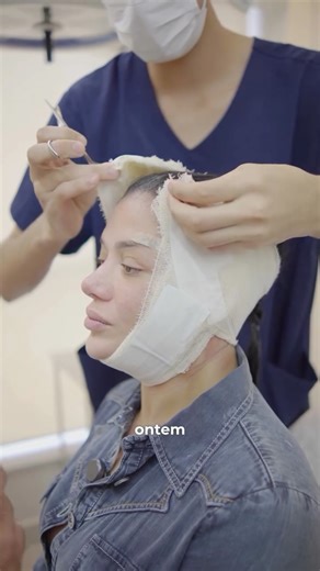 Dr. Olímpio Neto | Deep Plane Facelift on Instagram: "O pós-operatório do lifting facial Deep Plane costuma ser mais confortável do que muitos imaginam, especialmente quando comparado aos liftings convencionais, já que a tração ocorre em planos profundos e não na pele. O Deep Plane oferece um pós-operatório previsível, recuperação progressiva e um resultado natural e duradouro, sem estigmas cirúrgicos. Dr. Olímpio Neto Cirurgião Bucomaxilofacial CRO-GO 21531"