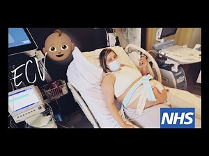 ECV PROCEDURE TO TURN BREECH BABY.