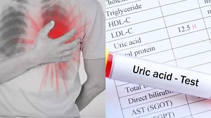 High uric acid may trigger heart attacks: Symptoms, risks, and prevention