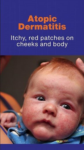Common Skin Rashes in Kids | Parents Must Know These Skin Problems in Children 👶🩺