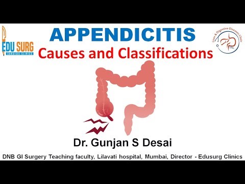 Acute Appendicitis Explained | Causes, Natural History and Classification