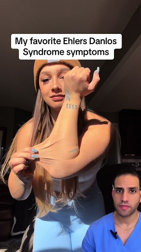 ¿Mujer elastica? 😱🧬 #ehlersdanlos #ehlersdanlossyndrome #doctor #doc #aprendeentiktok