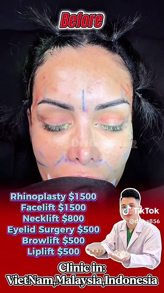 Enhance Your Beauty with Cosmetic Surgery Options