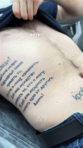 УДАЛЯЕМ ЛЮБЫЕ ТАТУ В САНКТ-ПЕТЕРБУРГЕ | до ЧИСТОЙ кожи 🔥