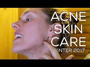 ❄️ My #Acne Skincare Routine For Winter! | Cassandra Bankson