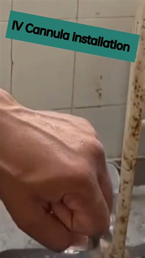 💉 “Cannula Installation Step-by-Step | Safe IV Insertion Tutorial” #youtubeindia #medical