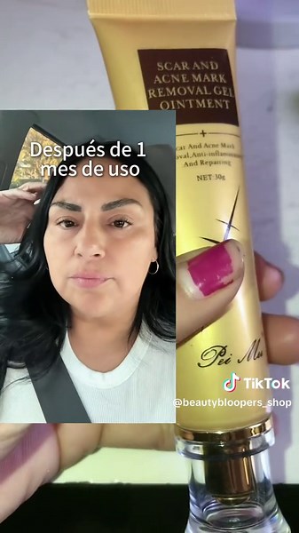 To order plz call/WhatsApp-9826529465 #skincare #deliveryallovernepal #fyp