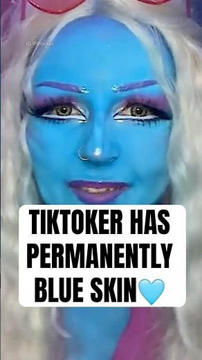 TikToker Has Permanently Blue Skin #short #alienmakeup #viralshort